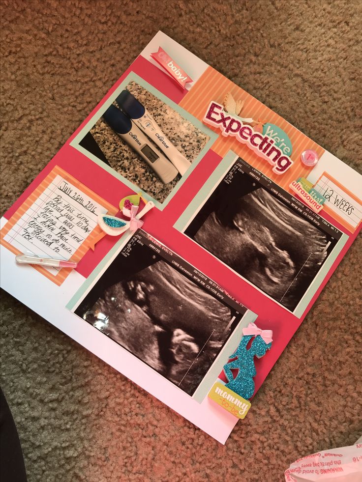 an image of a magazine with pictures on the front and back cover that says expecting