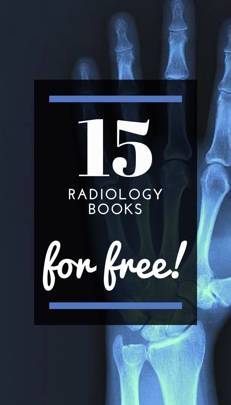 an x - ray image with the words 15 radiology books for free on it