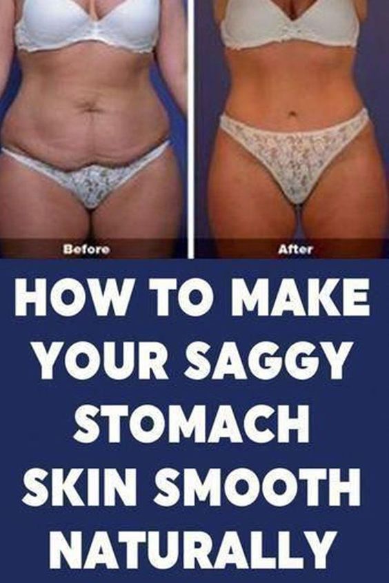 Sagging Belly, Flabby Stomach, Tighten Stomach, Sagging Cheeks, Skin Tightening Stomach, Loose Belly, Tighten Loose Skin, Saggy Skin, Eat Better