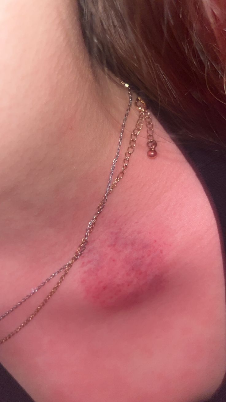 a close up of a woman's chest with red spots on her neck chain