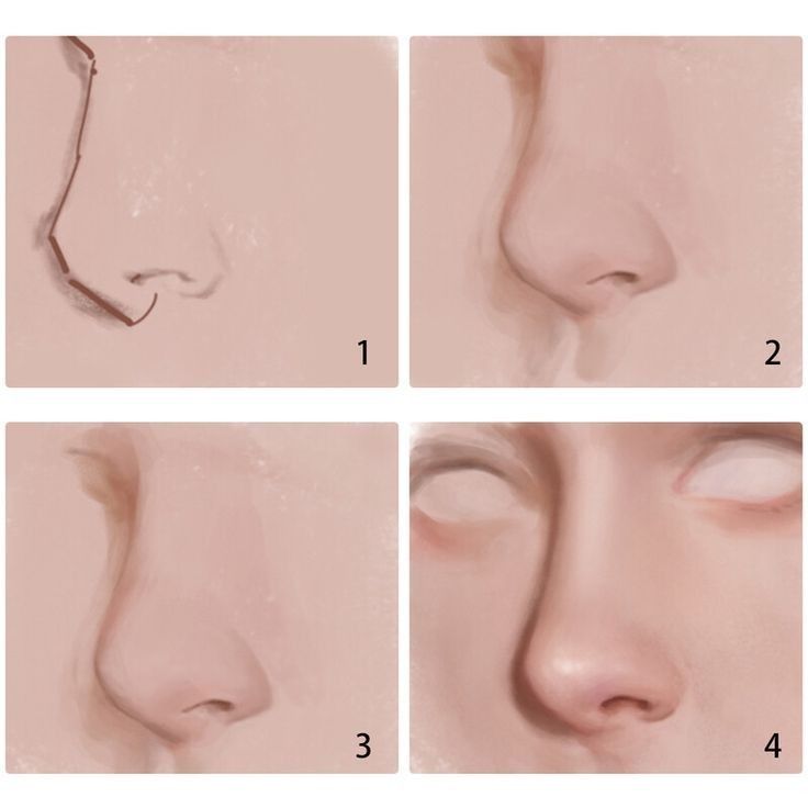 four different stages of nose surgery