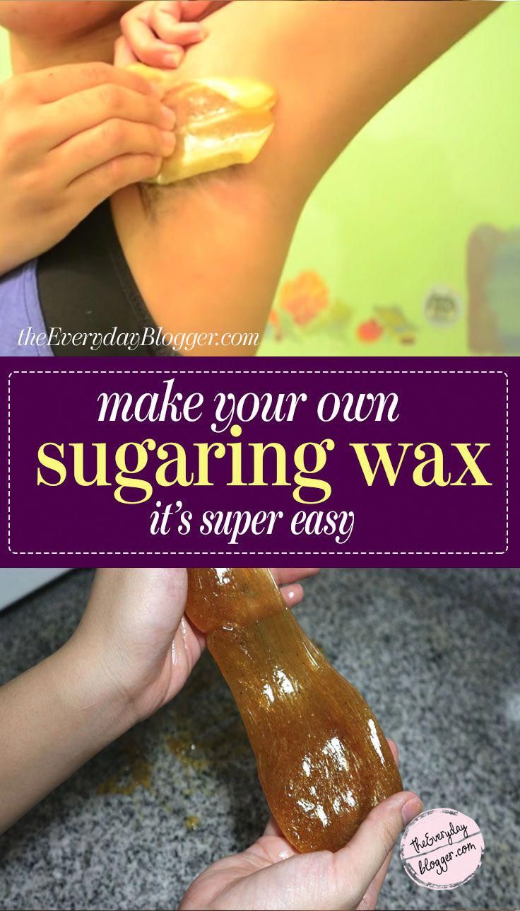 Sugar Waxing - Learn how to make sugar wax at home and when done properly, it removes hair from the roots. Sugaring hair removal is very similar to waxing and it isn't as painful because it doesn't stick as much to the skin, and is used at room temperature. Sugar Wax Recipe No Strips, Homemade Waxing, Diy Sugar Wax Recipe, Sugar Wax At Home, Diy Sugar Wax, Home Made Wax, Homemade Hair Removal, Sugar Wax Recipe, Wax Recipe