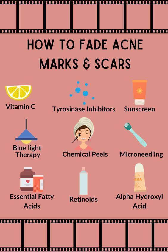 Face Visualization, Skin Lightening Diy, Fade Acne Marks, Honey Beauty, How To Fade, Acne Scarring, Skin Care Routine Order, Love And Beauty, Natural Face Skin Care