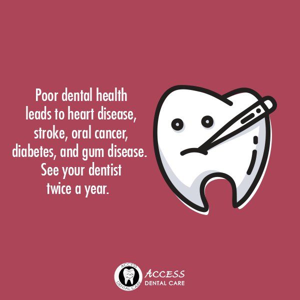 Dental Posts, Dental Posters, Dental Fun, Dental Facts, Dental Emergency, Pharmacology Nursing, Dental Life, Dental Marketing, Nursing School Tips