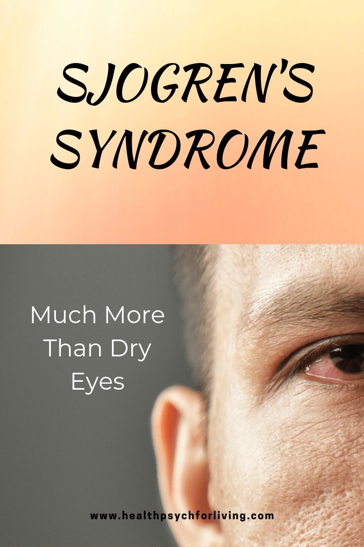 Sjogrens Syndrome Diet, Autoimmune Disease Symptoms, Systemic Inflammation, Sjogrens Syndrome, Inflammation Causes, Autoimmune Disorder, Chronic Inflammation, Nerve Pain, Dry Eyes