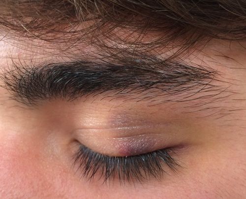 a close up view of someone's eye with hair on the top of their head