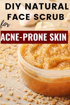 Diy Body Scrub For Acne, Acne Soap Diy, All Natural Face Scrub, Diy Face Scrubs For Acne, Natural Face Scrub For Acne, Homemade Acne Scrub, Best Facial For Acne, Face Scrubs For Acne, Facial Scrubs Diy Exfoliating For Acne