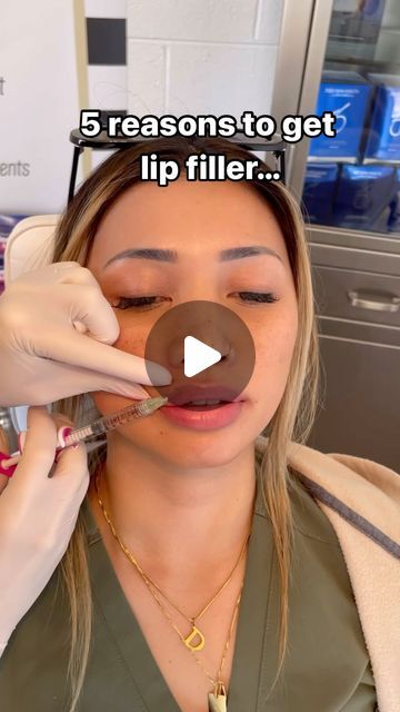 Nicole Smith | California | Botox, Filler, Anti-aging on Instagram: "Just go for it! Lip filler volume & hydration can build self confidence! 💋 . . . 5 reasons to get lip filler… 1. Improve lip hydration  2. Volume 3. Enhance shape 4. Correct lip asymmetries  5. Look younger!  My patient wanted some extra lip plumping and hydration with Juvederm Volbella.   Keep in mind that the final result is at 2 weeks post lip injections. My patient is swollen and her lips will settle nicely!   #lipfiller #lipinjections #lips" 1.5 Ml Lip Filler, Rounded Lip Filler, Volbella Lips Before And After, Lip Filler Lips, Lip Injections Before And After 0.5ml, Small Lip Fillers Before And After, M Shaped Lips With Filler, Lip Filler 1 Syringe, Keyhole Lip Fillers