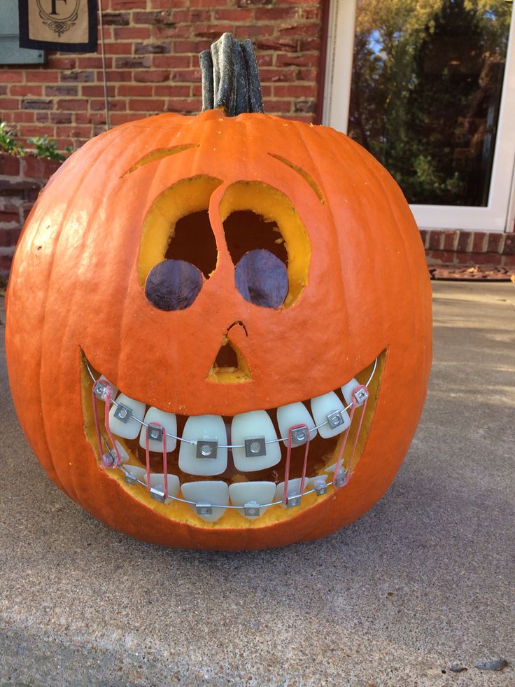 Braces pumpkin Dental Themed Pumpkins, Pumpkin With Braces, Dentist Pumpkin Ideas, Dentist Halloween Decorations, Halloween Dental Office Ideas, Dental Pumpkin Ideas, Halloween Braces, Dentist Lifestyle, Pumpkin Mouth