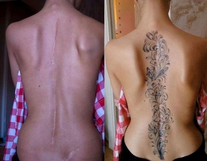 the back of a man with tattoos on his upper and lower back, before and after treatment