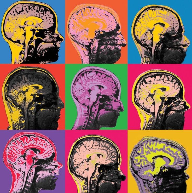 multiple images of the human brain in different colors