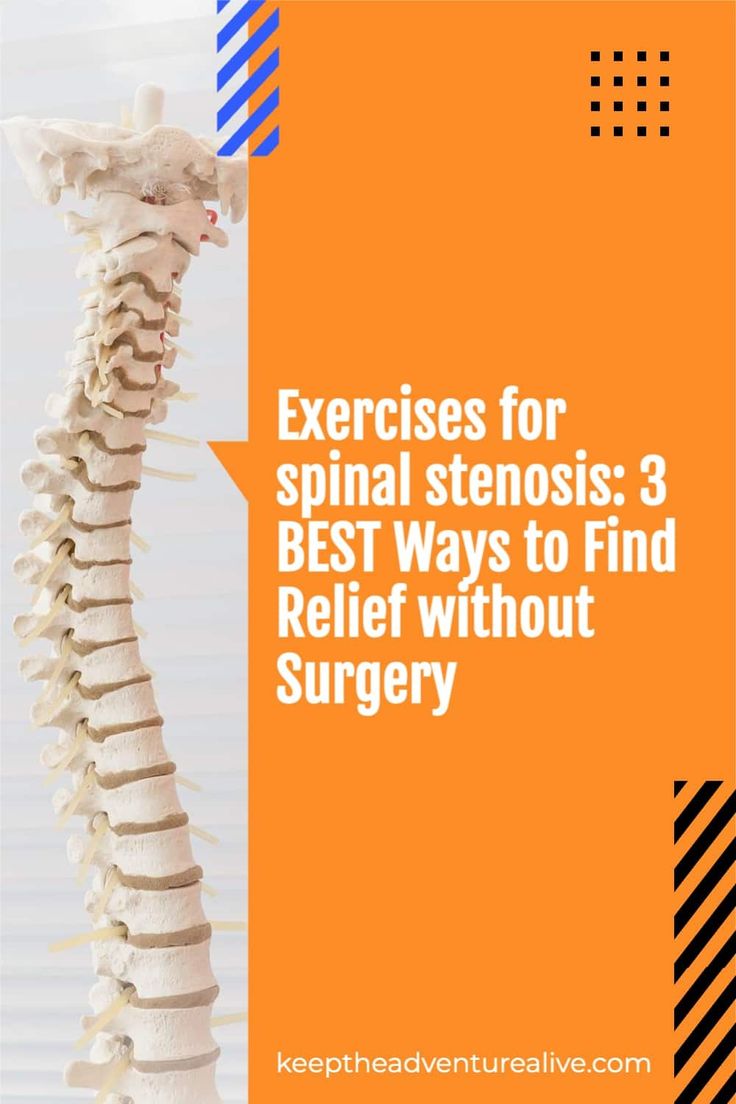 the back of a skeleton with text that reads exercises for spiral stenosis 3 best ways to find relief without surgery