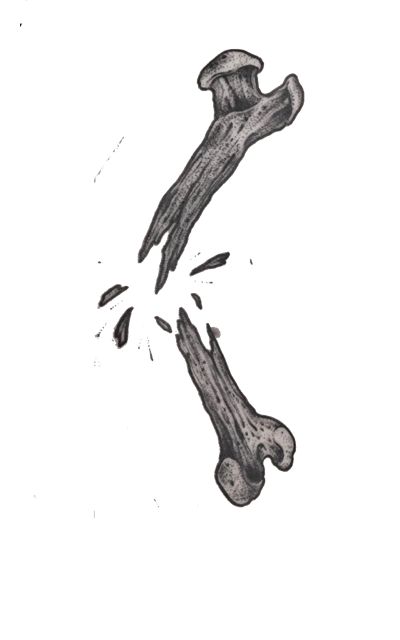 a drawing of two bones that have been split in half to form the same bone