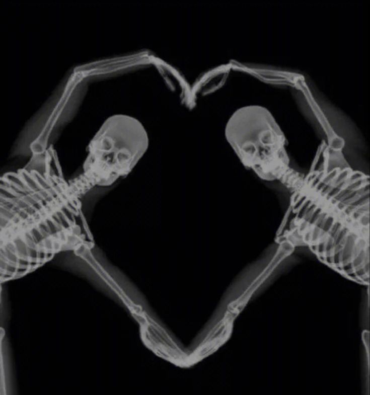 two skeletons making a heart shape with their hands