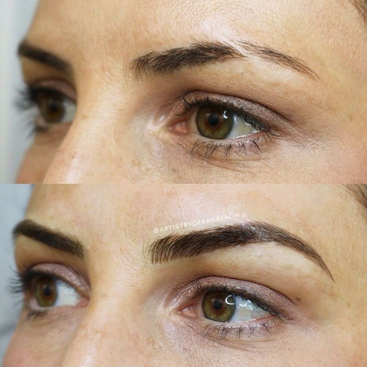 Have a scar that's causing you to lose hair? Microblading can help that! It makes it look so natural and flawless! Scar On Eyebrow, Scar Aesthetic, Eyebrow Scar, Permanent Brows, Hope Core, Eyebrow Slits, Scar Cover Up, Oddly Specific, Emily Carr