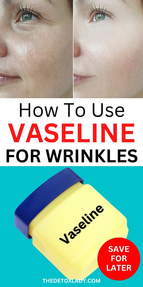 Here is a very effective home remedy to help you transform your face overnight! Learn how to use Vaseline and baking soda for face transformation the right way. This remedy is very effective in reducing fine lines and giving your face a healthy glow. Baking Soda For Face, Wrinkles Remedies Face, Home Remedies For Wrinkles, Face Transformation, Vaseline Uses, Baking Soda Face, Uses For Vicks, Wrinkle Remedies, Skin Care Wrinkles