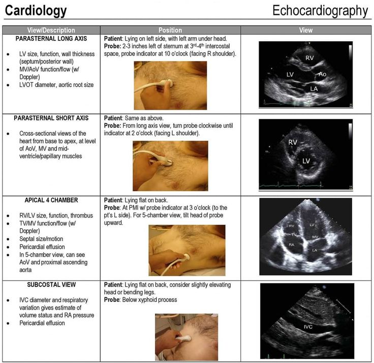 an x - ray image shows the different types of radiographs and their corresponding features