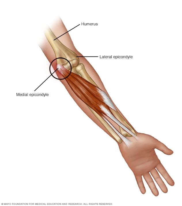 an arm with muscles labeled in the upper half and lower half, showing carpelus