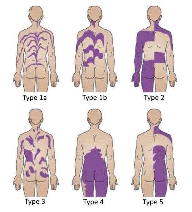 an image of different types of human body