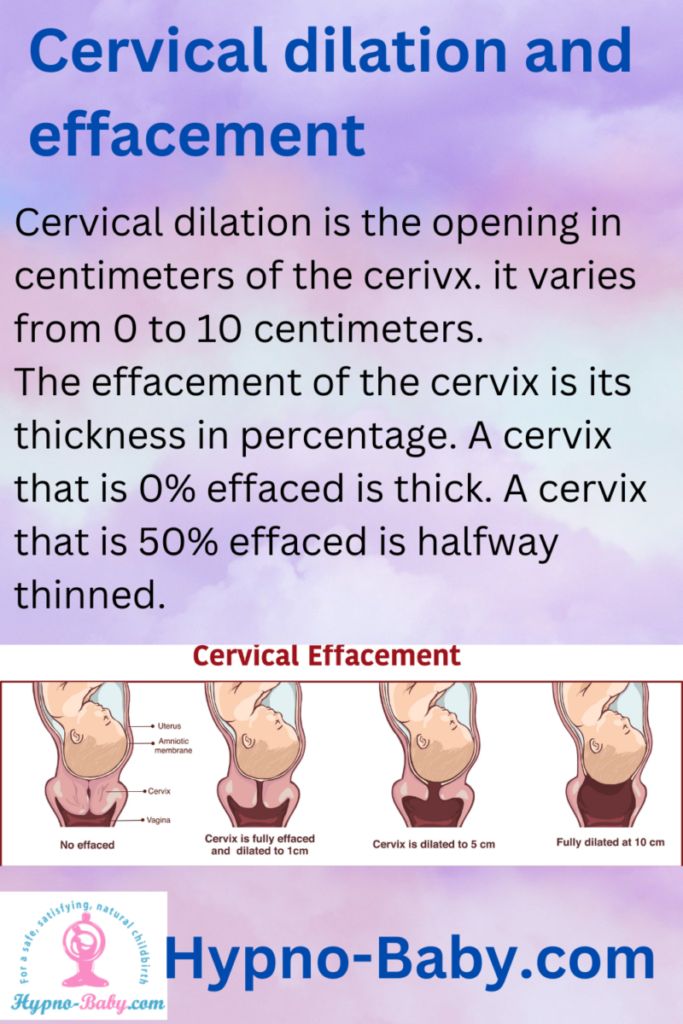 an info sheet with instructions on how to use the cervical dillation and effacement