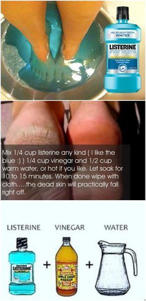 Foot Spa at Home Skin Care Routine, Skin Care, Skin