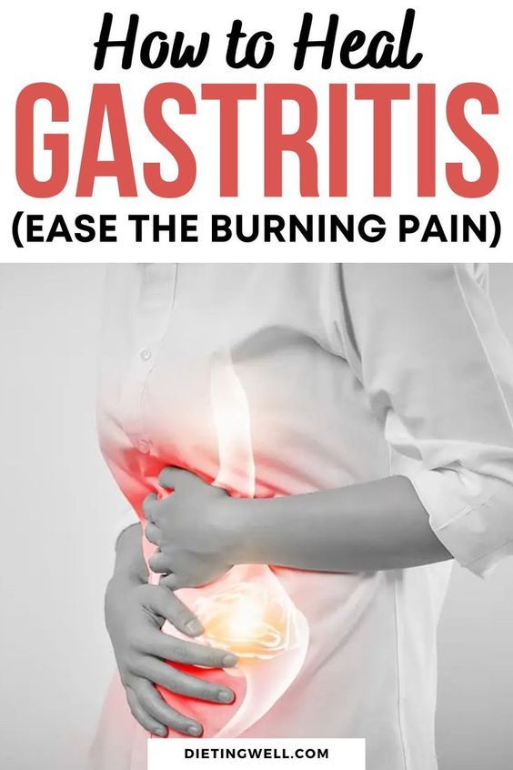 Effective strategies to heal gastritis and alleviate the burning pain | Natural remedies for gastritis relief | Diet tips to reduce inflammation and ease gastritis symptoms | Foods to avoid for gastritis and inflammation | Anti-inflammatory diet for gastritis | Best foods to soothe gastritis pain | Healing gastritis naturally with anti-inflammatory remedies Sensitive Stomach Diet, Stomach Pain Remedies, Ulcer Diet, Stomach Pain Relief, Remedies For Dry Mouth, Stomach Remedies, Home Remedies For Allergies, Reflux Remedies, Home Remedies For Warts