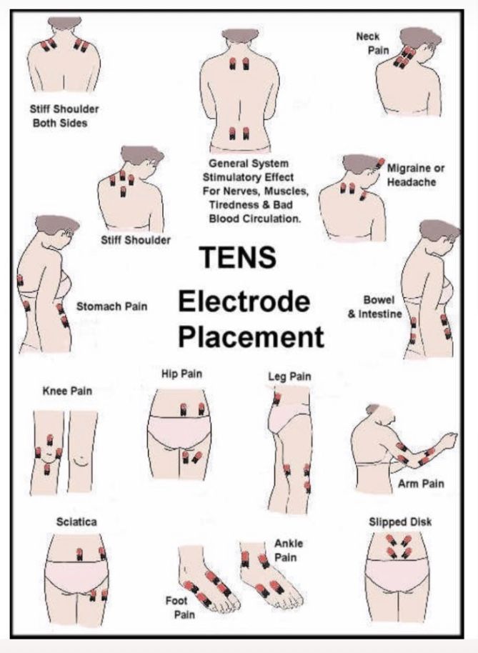 Tens Electrode Placement, Tens Unit Placement, Tens Machine, Severe Back Pain, Tens Unit, Ten Unit, Ankle Pain, Nerve Pain Relief, Joints Pain Relief