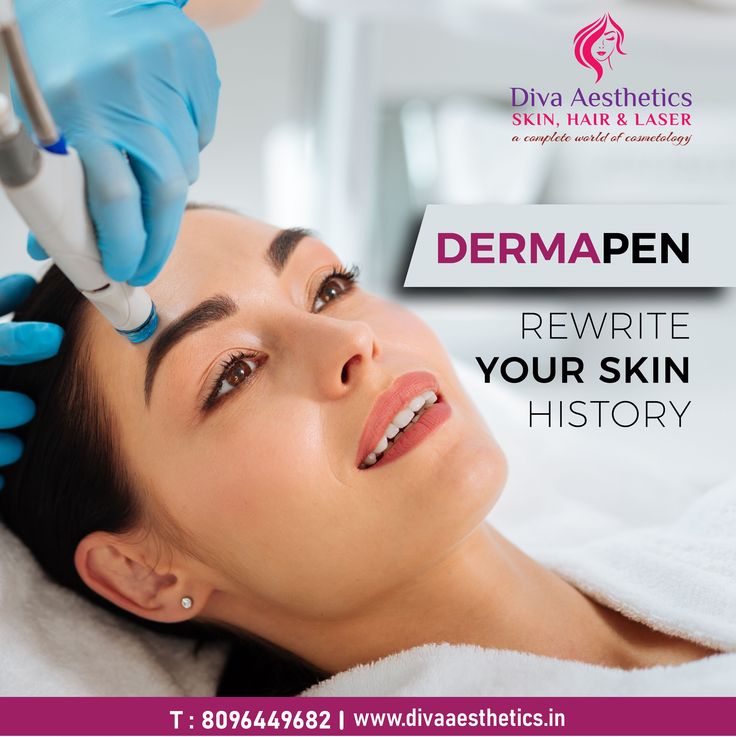 Rewrite your beauty with Derma pen at Diva call us: 8096449682 #divaaesthetic #ａｓｅｔｈ��ｅｔｉｃｓ #skinclinic #cosmotology #pimples #truebeauty #PIMPLE #acne #dermapen #skinclinics Derma Pen, Beauty Clinic, Skin Clinic, Laser Hair, Cosmetology, True Beauty, Diva, Acne, Pen