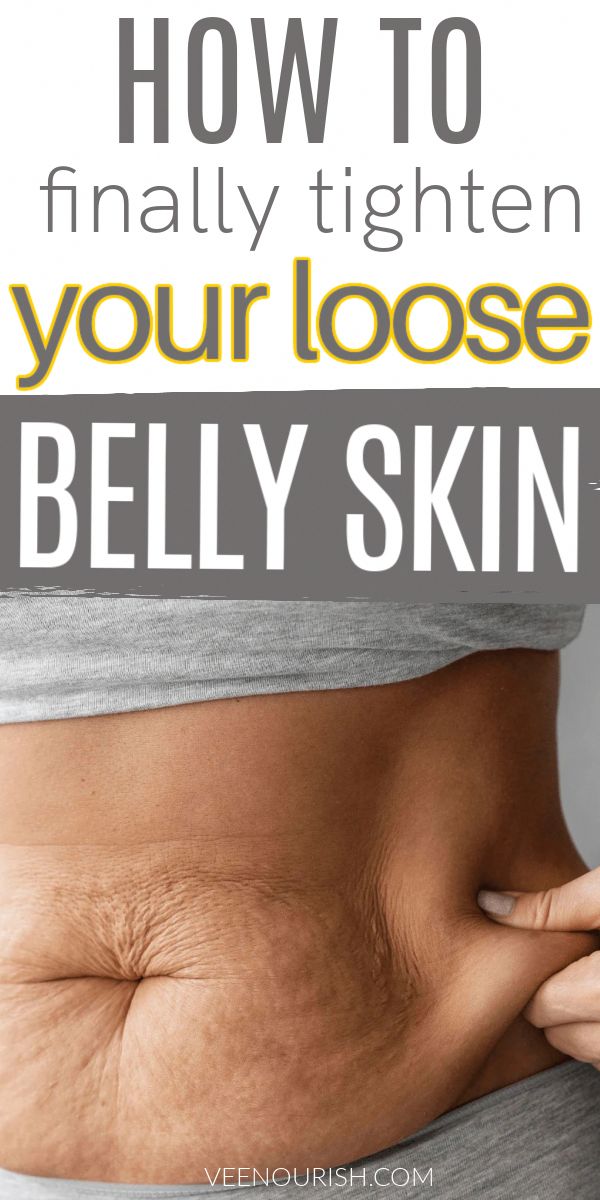 Loose belly skin can be a common concern for many mothers. It often occurs post-pregnancy, but it can also result from weight loss or aging. In this comprehensive guide, we'll explore what causes loose skin, its impact on the body, and most importantly, 10 effective and natural tips to tighten that skin. These tips are Loose Belly, Natural Glowing Skin, Post Pregnancy, Loose Skin, Glowing Skin, Skin