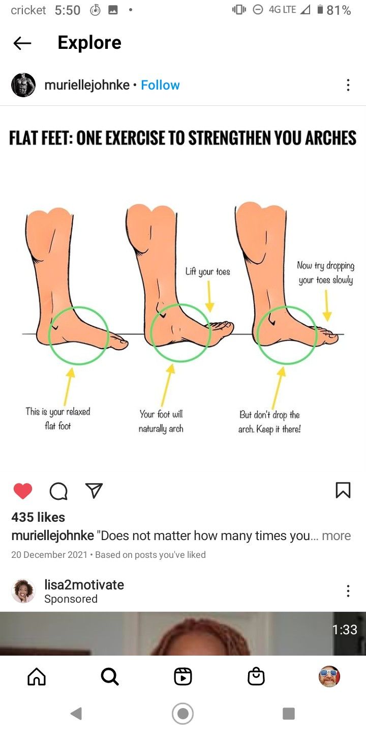 Exercise to build arch of foot Fix Flat Feet Arches, How To Fix Flat Feet Exercise, Arch Strengthening Exercises, Foot Arch Exercises, Fallen Arches Exercises, Shoe Dictionary, Flat Feet Exercises, Ballet Barre Workout, Healthy Vibes