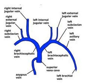 the major vessels of the heart are labeled in blue, and there is also an image of