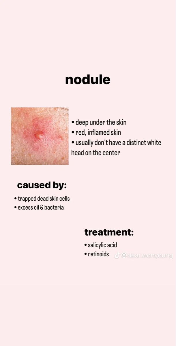 Dermatology Quotes, Dermatology Notes, Dermatology Aesthetic, Medical Esthetician, Esthetician School, Beauty Skin Quotes, Skin Facts, Skin Care Basics, Skin Care Business