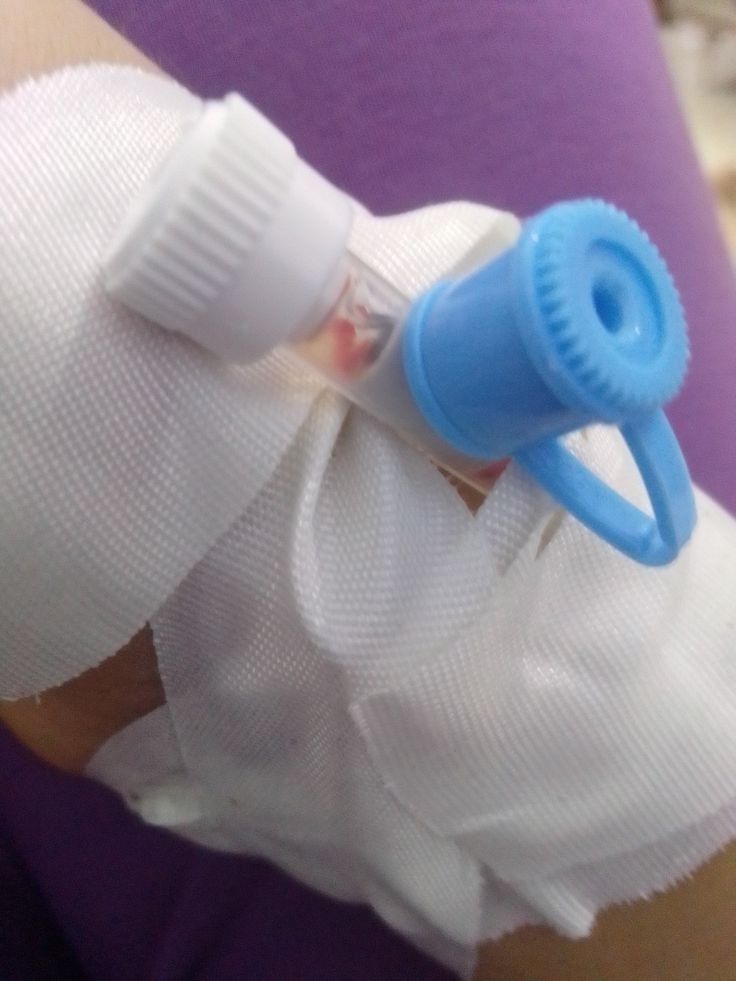 a person with bandages wrapped around their arm and an inhaler attached to the arm