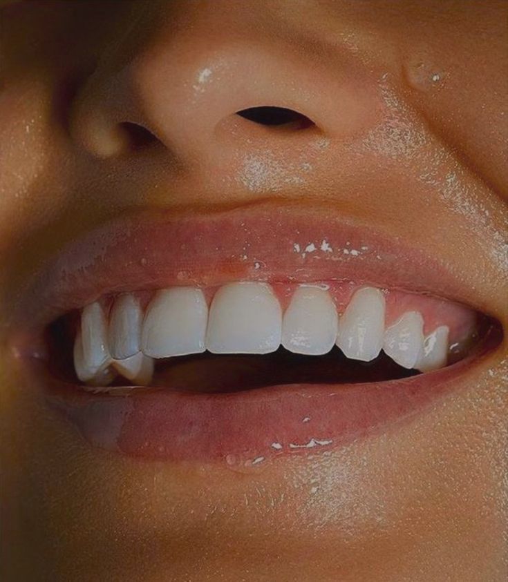 Whiten Teeth Fast, Peroxide Teeth Whitening, Teeth Aesthetic, Pretty Teeth, Beautiful Teeth, Teeth Whitening Gel, Straight Teeth, Perfect Teeth, Nice Teeth