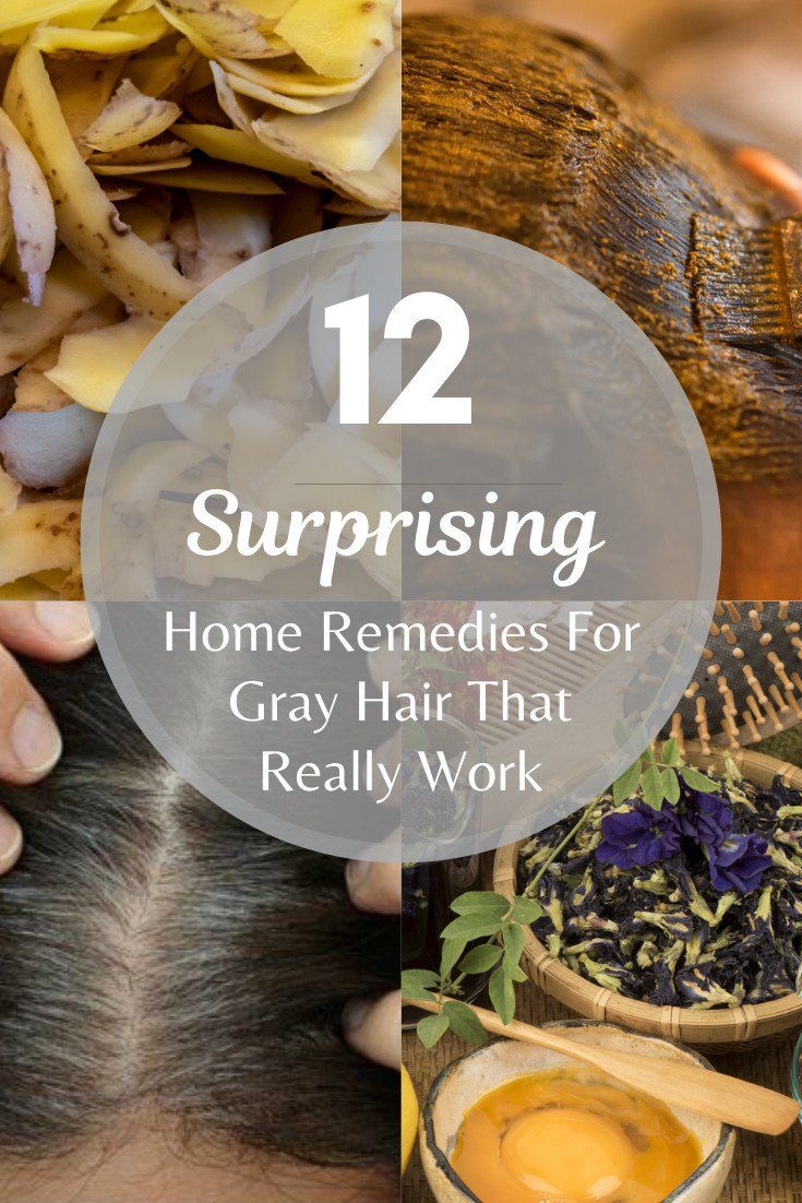 12 Surprising Home Remedies For Gray Hair That Really Work Grey Hair Natural Remedy, Cover Gray Hair Naturally, Grey Hair Home Remedies, Stop Grey Hair, Grey Hair Remedies, Prevent Grey Hair, Reverse Gray Hair, Home Remedies For Allergies, Home Remedies For Warts