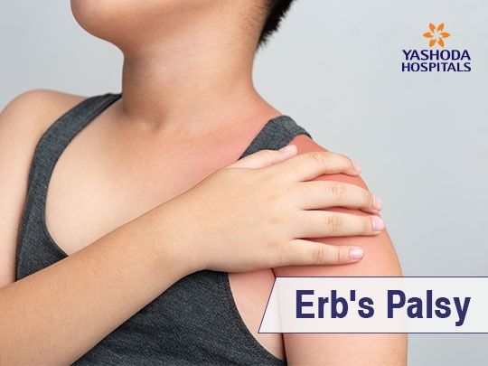 Erb's Palsy is a condition wherein paralysis of the arm is caused when the upper group of the arm’s main nerves are injured. It is a form of brachial plexus palsy which is a network of nerves near the neck that gives rise to all the nerves of the arm. Palsy means weakness and Brachial Plexus Birth Palsy causes weakness to the arm and loss of motion. It is usually caused when an infant’s neck is stretched to the side through a difficult delivery. Erb Palsy, Brachial Plexus, Physical Therapy, Plexus Products, Motion