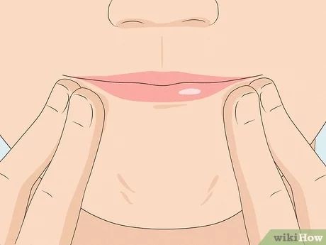 4 Ways to Get Rid of Jowls - wikiHow Jowl Exercises, Get Rid Of Jowls, Face Lift Exercises, Sagging Cheeks, Jawline Exercise, Sagging Face, Cleft Chin, Joints Pain Remedy, Chin Exercises