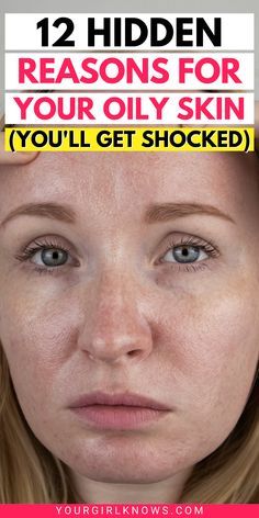 12 HIDDEN OILY SKIN CAUSES THAT CAN MAKE ANY SKIN FEEL GREASY AND PRONE TO ACNEYOURGIRLKNOWS Face Routine For Oily Skin Skincare, How To Get Rid Of Oily Skin, Get Rid Of Oily Skin, Oily Skin Remedy, Face Mapping Acne, Bad Acne, Tips For Oily Skin, Oily Face, Open Pores