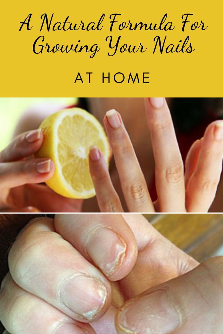 Nail Growth Faster, Grow Long Nails, Essential Oils For Hair, How To Grow Nails, Nail Growth, Best Shampoos, Nail Health, Nails At Home, Natural Home Remedies