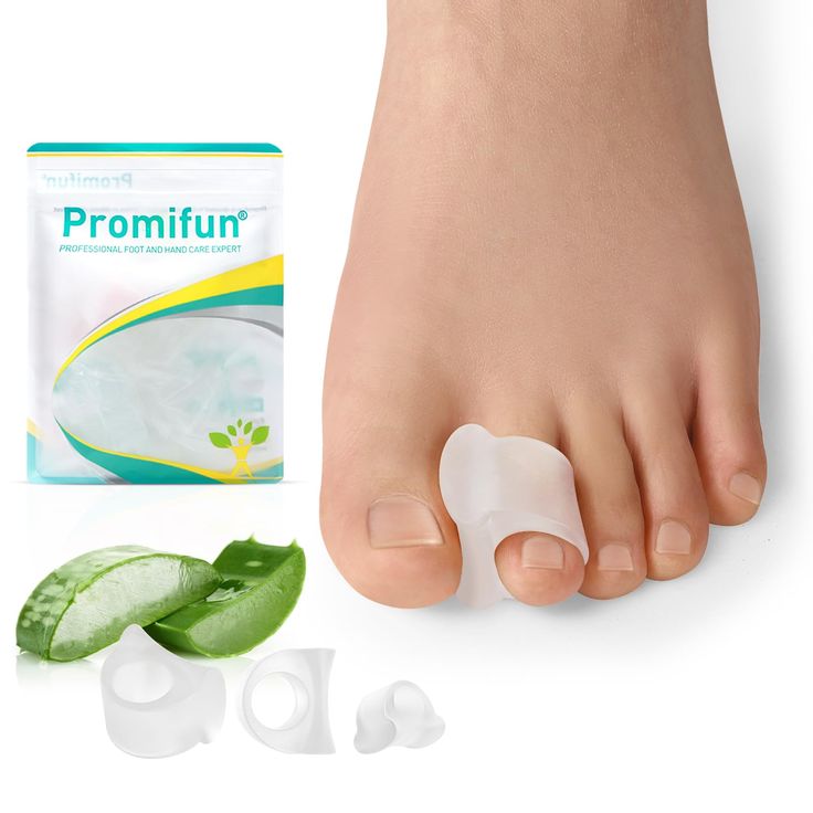 PRICES MAY VARY. 🌿Toe Separators Treatment: Single-ring silicone toe separators gently separate and realign the big toe, helping to strengthen the big toe and improve balance and stability by improving toe strength and scientifically correcting toe position, thus reducing pain from bunions, overlapping toes, hammertoes, drifting toes, curled toes, sore toes, and painful toe friction. 🌵Gel With Aloe Vera Oil🌵: Our toe separator are made of soft, flexible, durable medical gel infused with aloe Toe Spacers, Toe Straightener, Aloe Vera Oil, Gel Toes, Aloe Vera Extract, Soft Gel, Foot Pain, 6 Packs, Aloe Vera