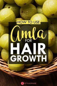 Amla Powder, Natural Hair Growth Oil, Biotin Hair Growth, Amla Oil, Biotin Hair, Best Hair Care Products, Growth Hair, Hair Dandruff, Boost Hair Growth