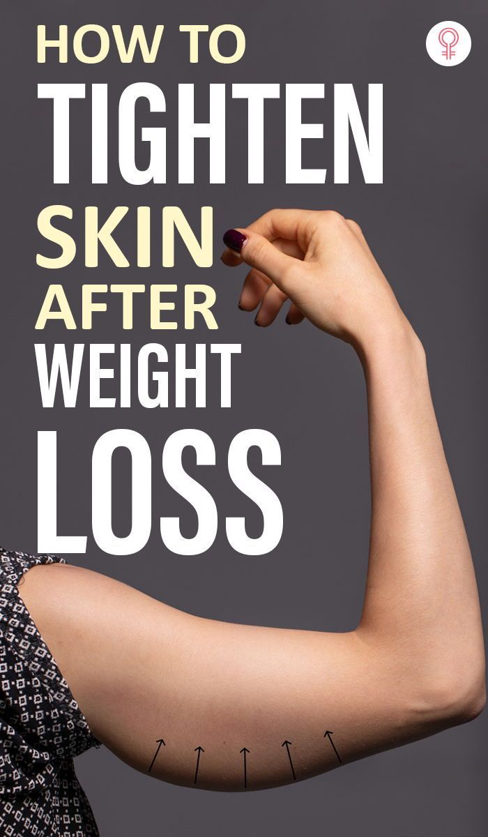 How To Tighten Skin After Weight Loss: You have to be strong physically and mentally to achieve the targeted weight. But if your skin has become loose in the process, worry not. There are ways to tighten skin after weight loss. Your skin may sag and lose elasticity during rapid weight loss as it doesn’t get enough time for its shrinkage. However, the right practices can help. Skin Tightening Remedies, Tighten Loose Skin, Tighten Skin, Saggy Skin, Workout Without Gym, At Home Workout Plan, Weight Workout Plan, Loose Skin, Better Health