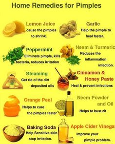 Here Are 15 DIY Hacks, Tips and Tricks That Will Make That Acne Vanish Overnight! beauty diy health viral viral right now viral posts Home Remedies For Pimples, Pimples Remedies, Skin Care Routine For 20s, Overnight Beauty, Natural Acne Remedies, Natural Acne, Home Remedies For Acne, How To Get Rid Of Pimples, Beauty Diy