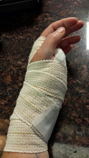 a hand wrapped in bandages sitting on top of a counter