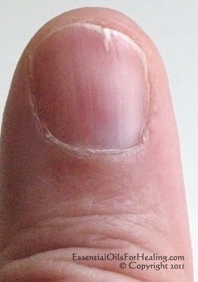 Strong Nails Diy, Essential Oils For Healing, Oils For Healing, Nail Remedies, Split Nails, Cracked Nails, Nails Healthy, Essential Oils Guide, Nail Repair