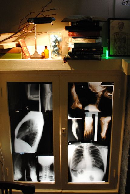 an x - ray image is displayed in a cabinet