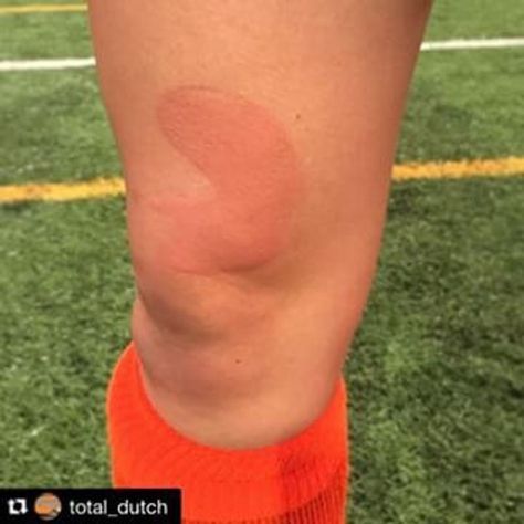 a close up of a soccer player's knee with an injury on his leg