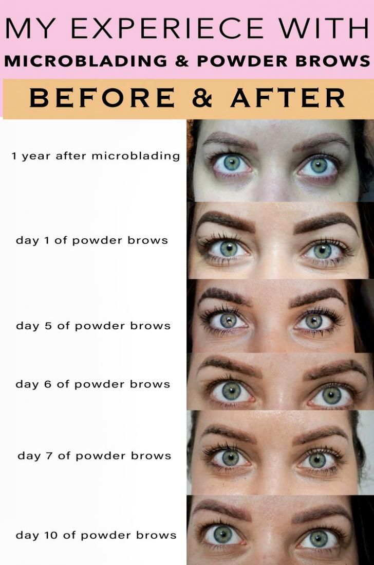 MICROBLADING AND POWDER BROWS- EYEBROW TATTOO EXPIERIENCE- DAY 1 TO DAY 14 HEALING PROCESS- AFTERCARE INSTRUCTIONS- DOES IT HURT- HOW LONG DOES IT LAST. Powder Brows Healing Stages, Microblading Vs Ombre Eyebrows, Healed Microbladed Eyebrows, Healed Powder Brows, Microblading And Powder Eyebrows, Ombre Eyebrows Healing Process, Brow Shading Tattoo, Eyebrow Tattoo Healing Process, Pmu Brows Healing Process