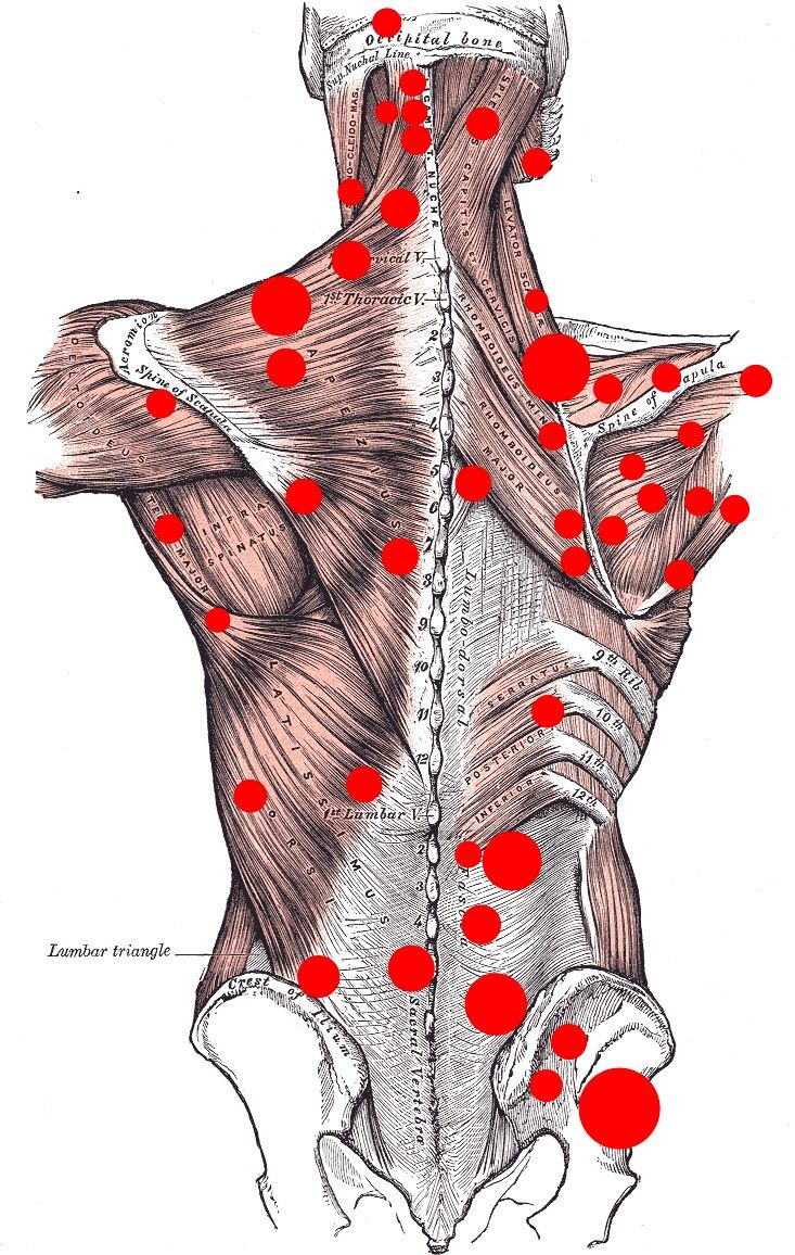 Punkty Spustowe, Muscle Knots, Massage Therapy Techniques, Trigger Point Therapy, Reflexology Massage, Trigger Point, Shiatsu Massage, Massage Benefits, Joints Pain Relief