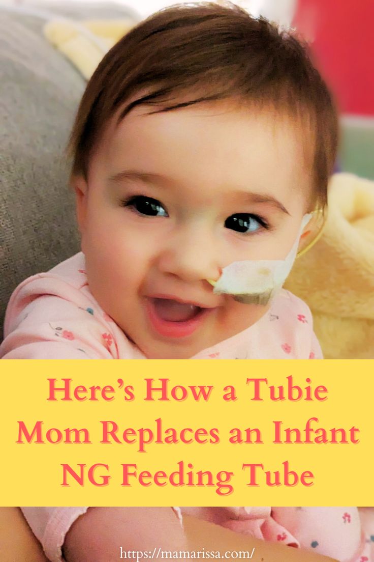 a baby with a tube in her mouth and the words here's how a tubie mom replaces an infant ng feeding tube